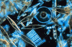 Various environmental factors are taking their toll on plankton the world over. This is bad news because, besides serving as a primary food source for many fish and whales, plankton plays a crucial role in mitigating global warming. Pictured: Microscopic phytoplankton from McMurdo Sound in Antarctica